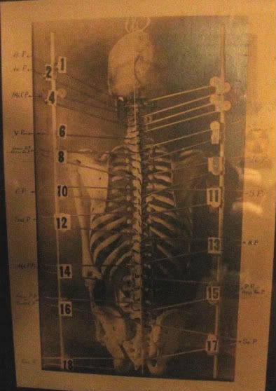Chiropractic print 2 With out the skin